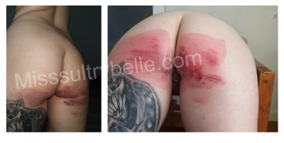 kat bruise and marks (1) (1).jpg