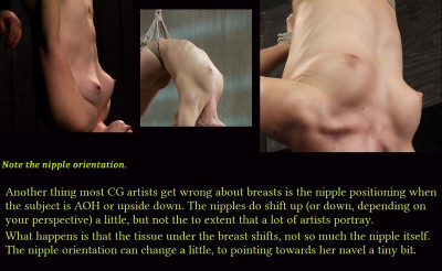 breast-nipple placement_upside down _txtj.jpg
