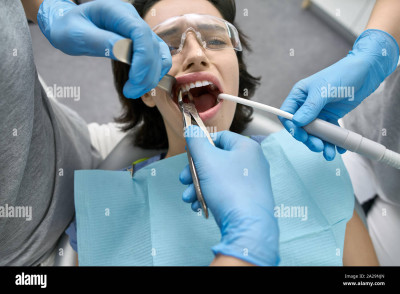 poor-girl-in-a-patients-bib-and-protective-glasses-in-a-dental-clinic-dentist-in-blue-latex-gloves-is-removing-her-tooth-with-a-help-of-a-cheek-retr-2A29NJN.jpg